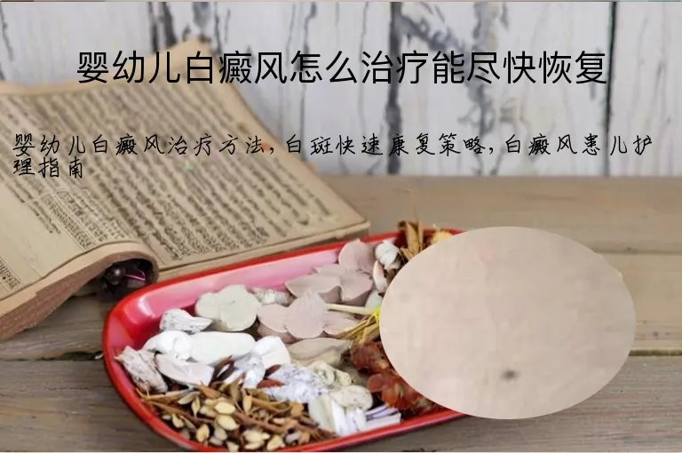 婴幼儿白癜风怎么治疗能尽快恢复