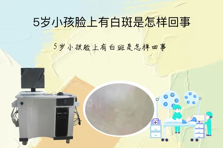 5岁小孩脸上有白斑是怎样回事