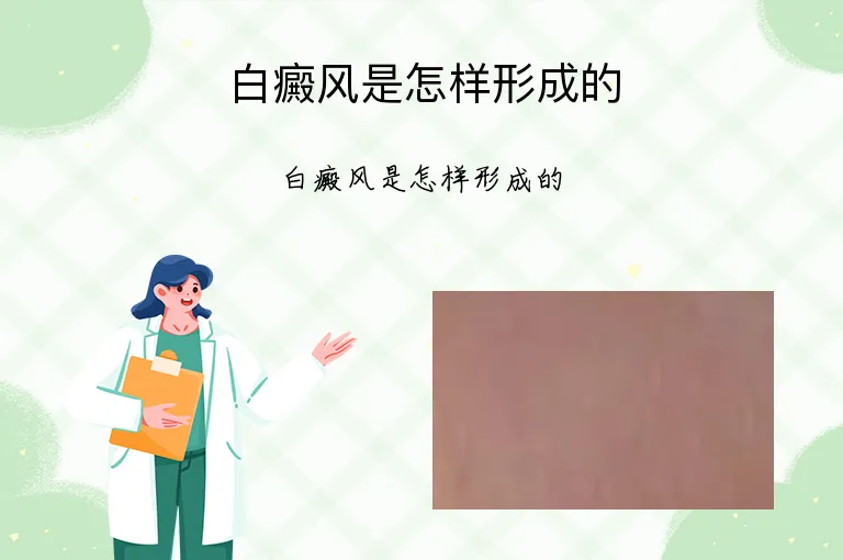白癜风是怎样形成的