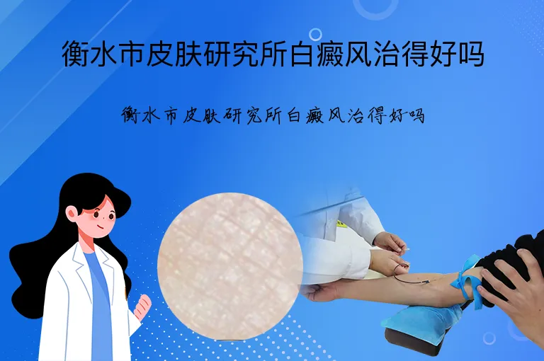 衡水市皮肤研究所白癜风治得好吗
