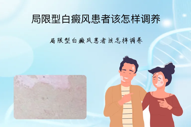 局限型白癜风患者该怎样调养