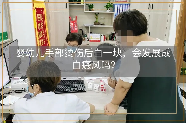 婴幼儿手部烫伤后白一块，会发展成白癜风吗？