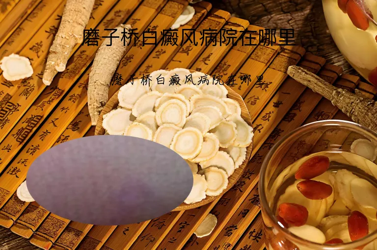 磨子桥白癜风病院在哪里