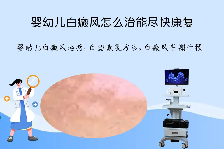 婴幼儿白癜风怎么治能尽快康复