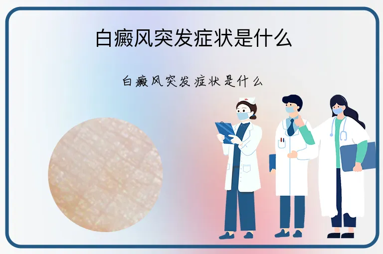 白癜风突发症状是什么