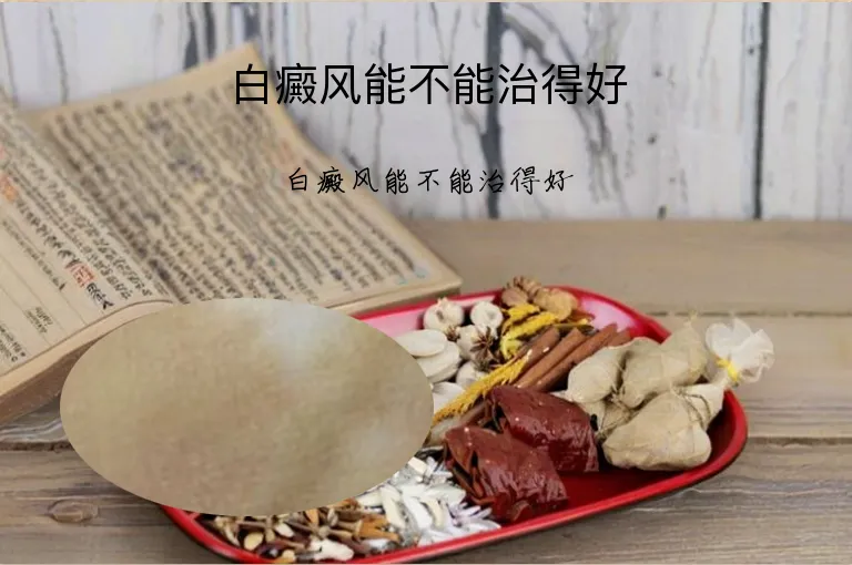 白癜风能不能治得好