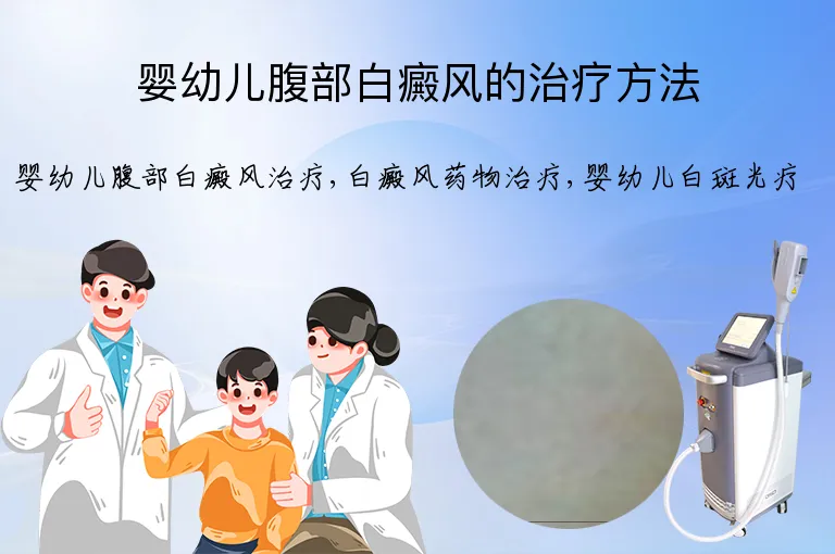 婴幼儿腹部白癜风的治疗方法