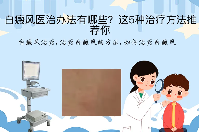 白癜风医治办法有哪些？这5种治疗方法推荐你
