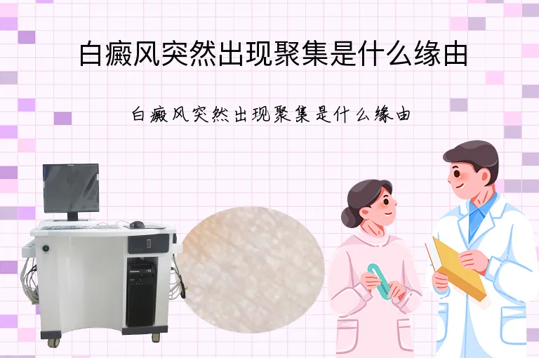 白癜风突然出现聚集是什么缘由