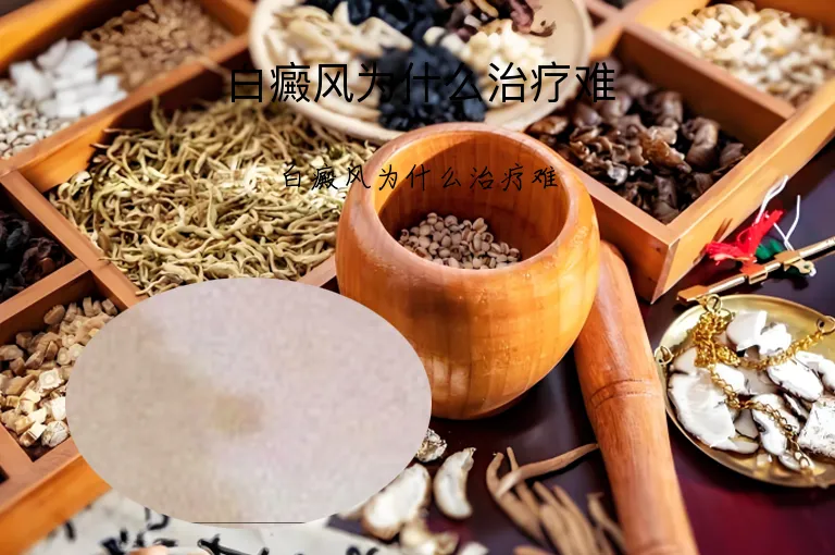 白癜风为什么治疗难