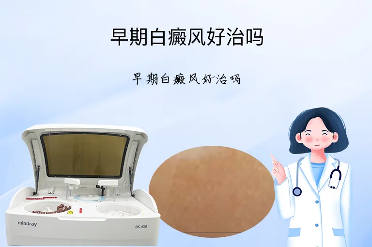 早期白癜风好治吗
