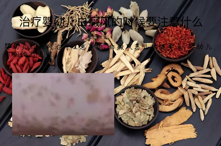 治疗婴幼儿白癜风的时候要注意什么