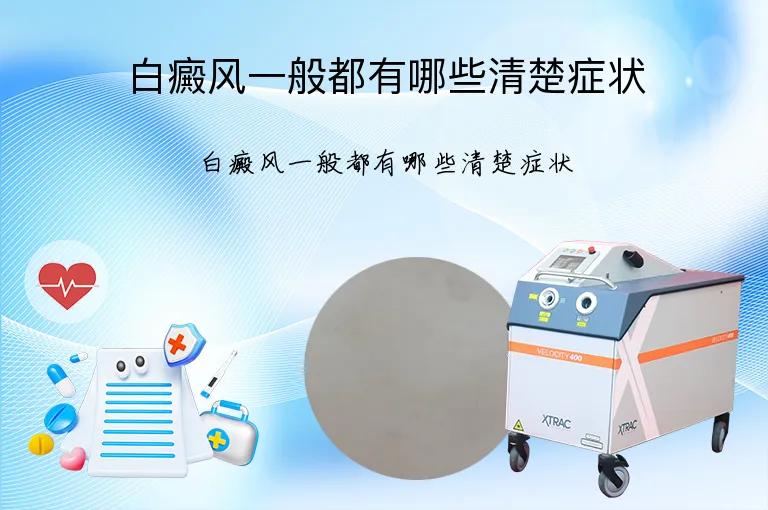 白癜风一般都有哪些清楚症状