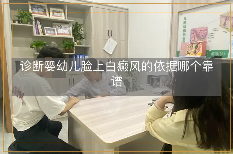 诊断婴幼儿脸上白癜风的依据哪个靠谱