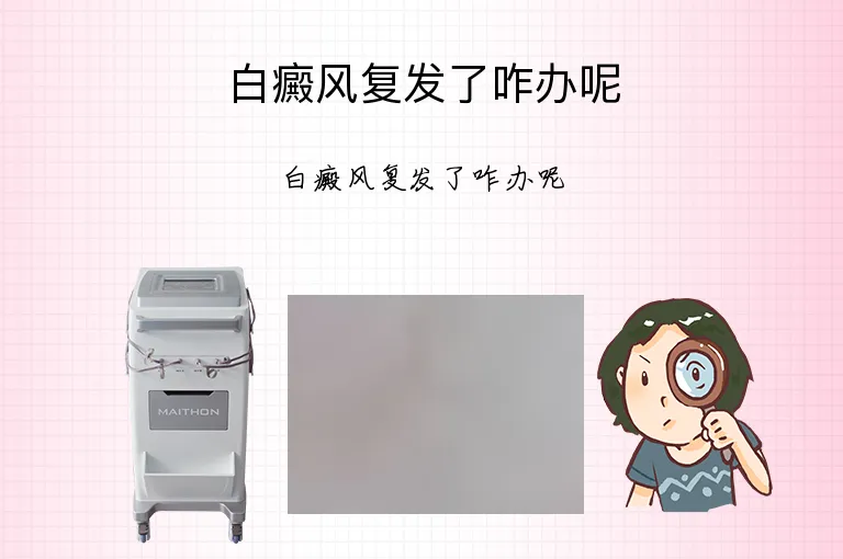 白癜风复发了咋办呢