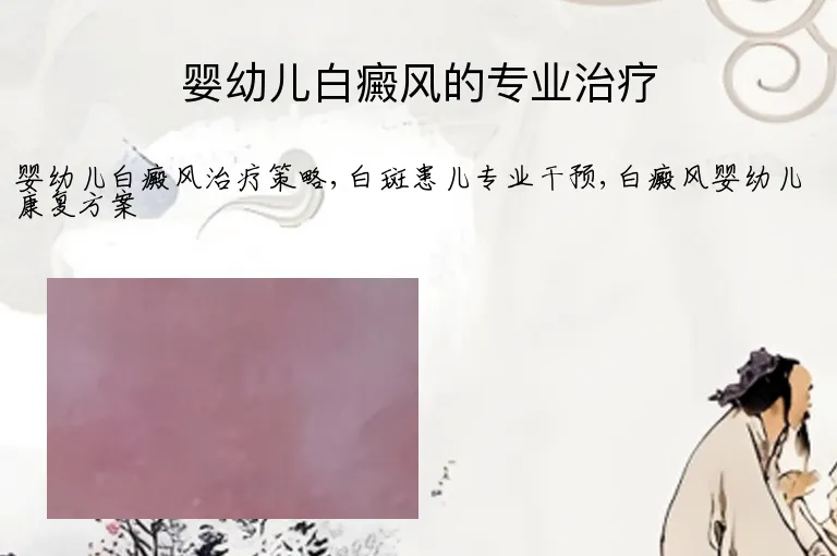 婴幼儿白癜风的专业治疗