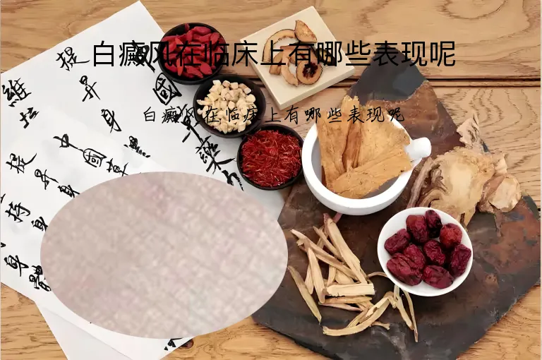 白癜风在临床上有哪些表现呢