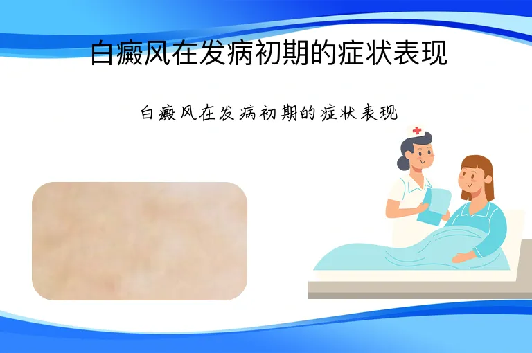 白癜风在发病初期的症状表现