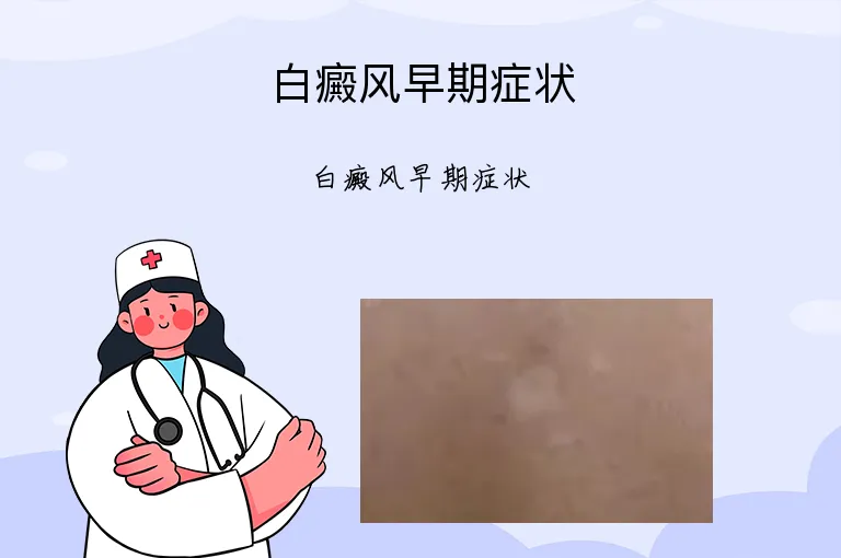 白癜风早期症状