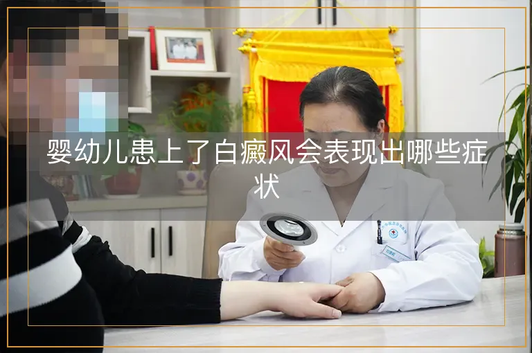 婴幼儿患上了白癜风会表现出哪些症状