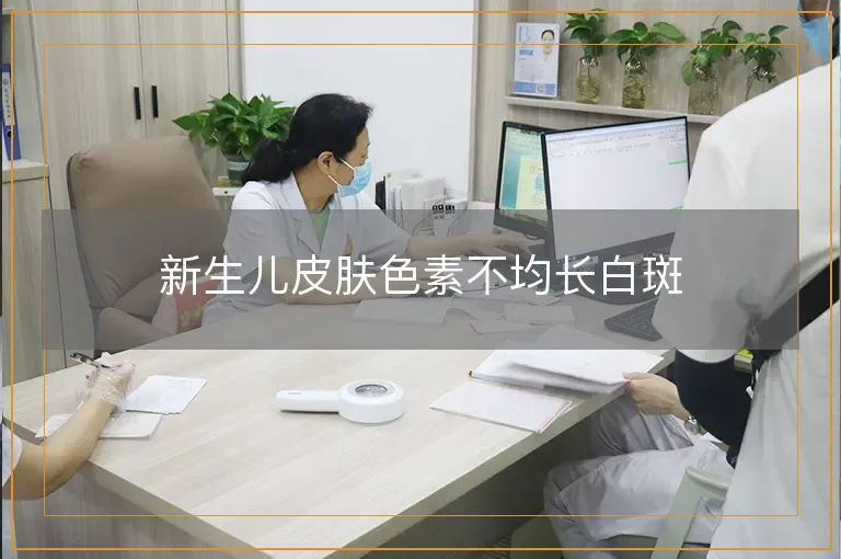 新生儿皮肤色素不均长白斑
