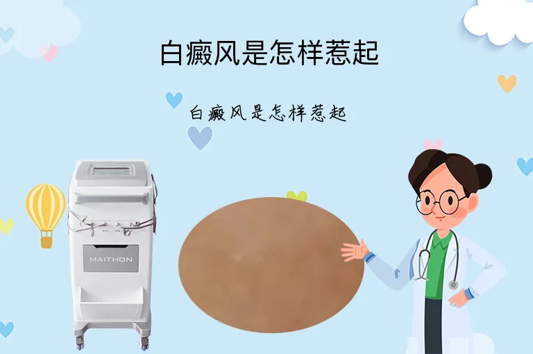 白癜风是怎样惹起