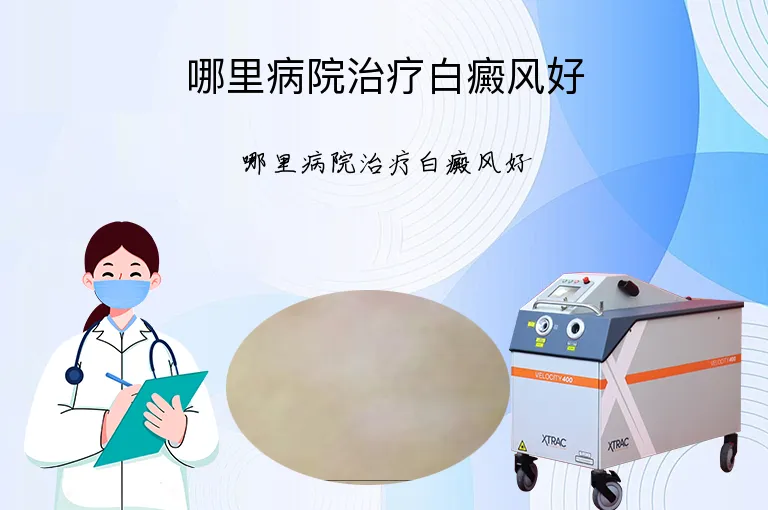 哪里病院治疗白癜风好