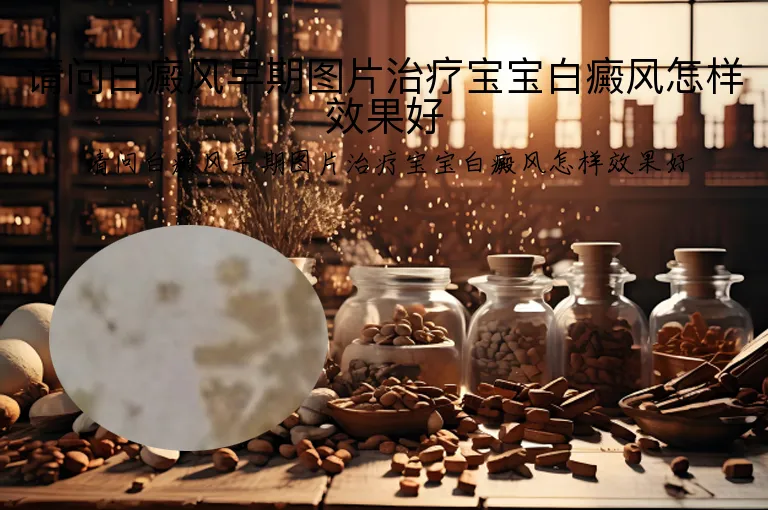 请问白癜风早期图片治疗宝宝白癜风怎样效果好