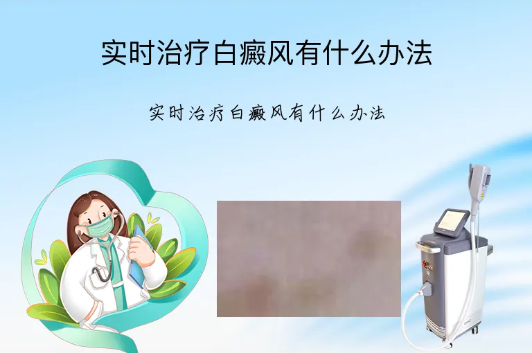 实时治疗白癜风有什么办法