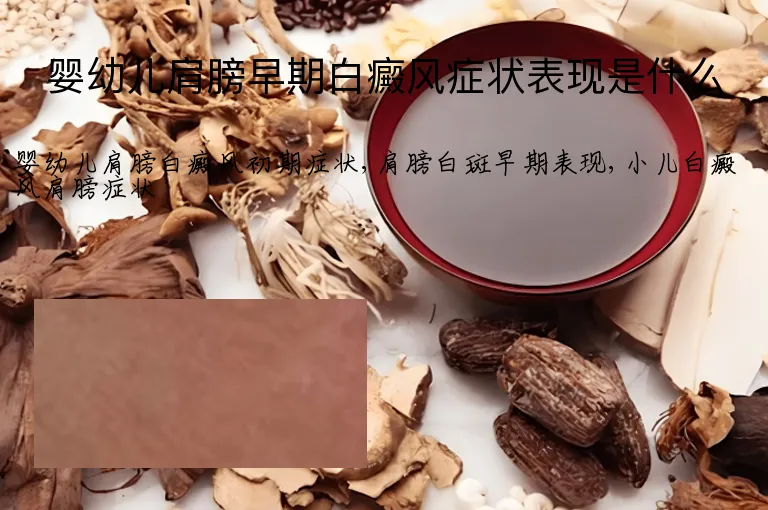 婴幼儿肩膀早期白癜风症状表现是什么