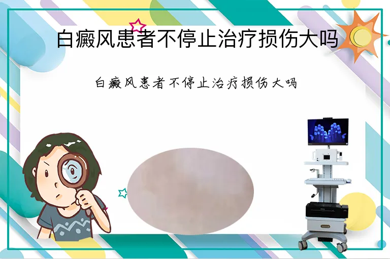 白癜风患者不停止治疗损伤大吗