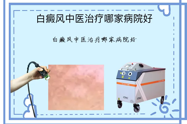 白癜风中医治疗哪家病院好