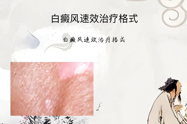 白癜风速效治疗格式
