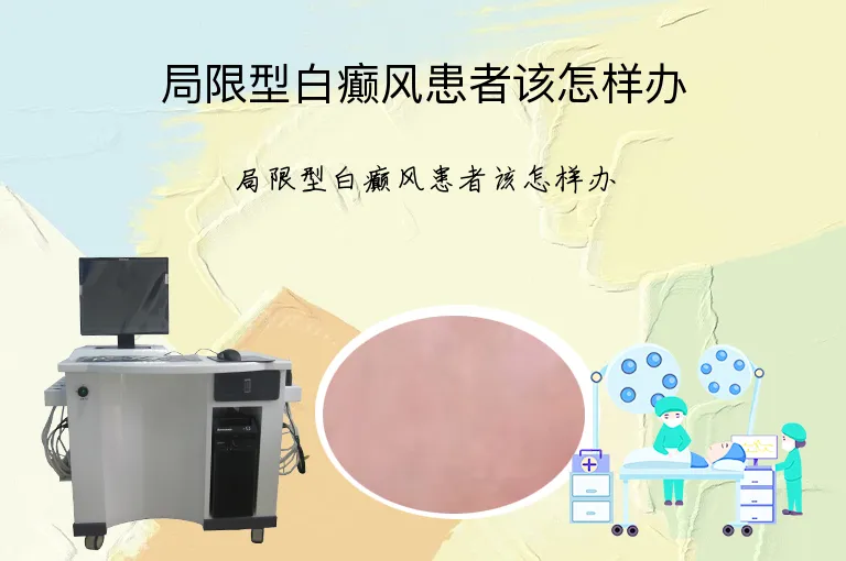 局限型白癫风患者该怎样办