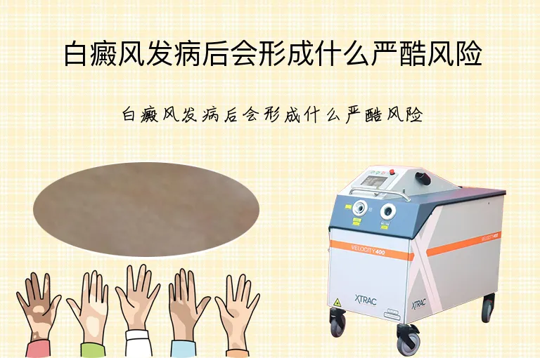 白癜风发病后会形成什么严酷风险