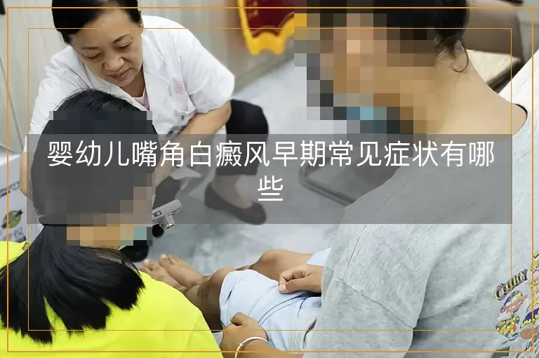 婴幼儿嘴角白癜风早期常见症状有哪些