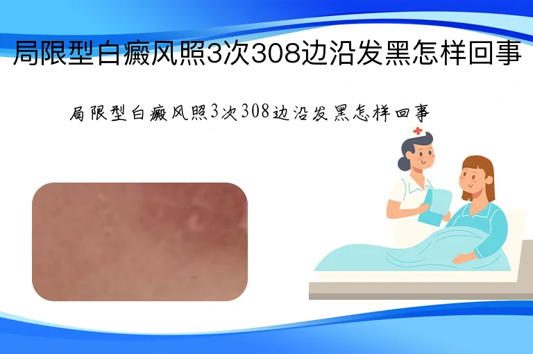 局限型白癜风照3次308边沿发黑怎样回事