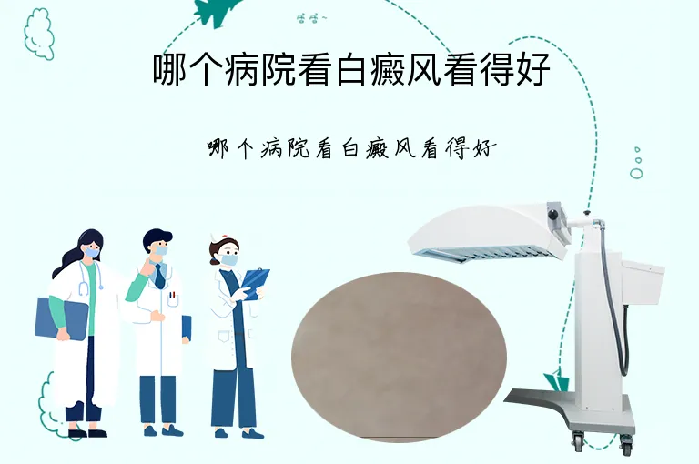 哪个病院看白癜风看得好