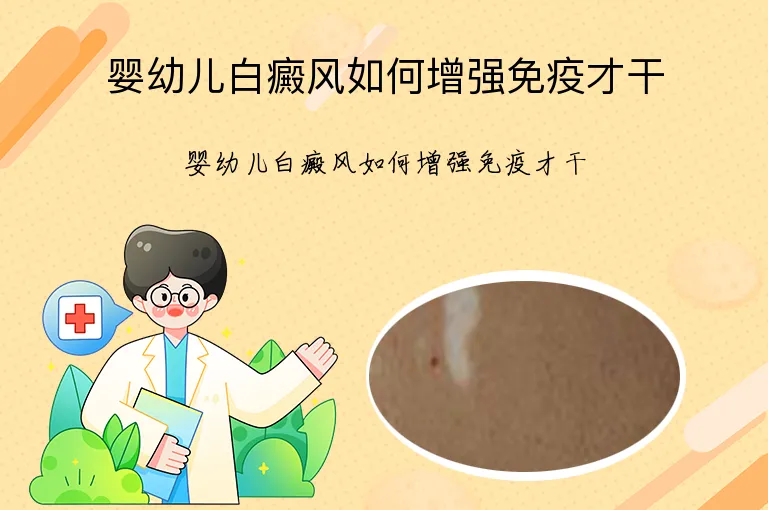 婴幼儿白癜风如何增强免疫才干