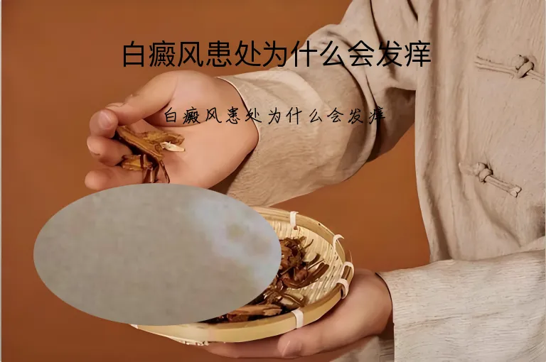 白癜风患处为什么会发痒