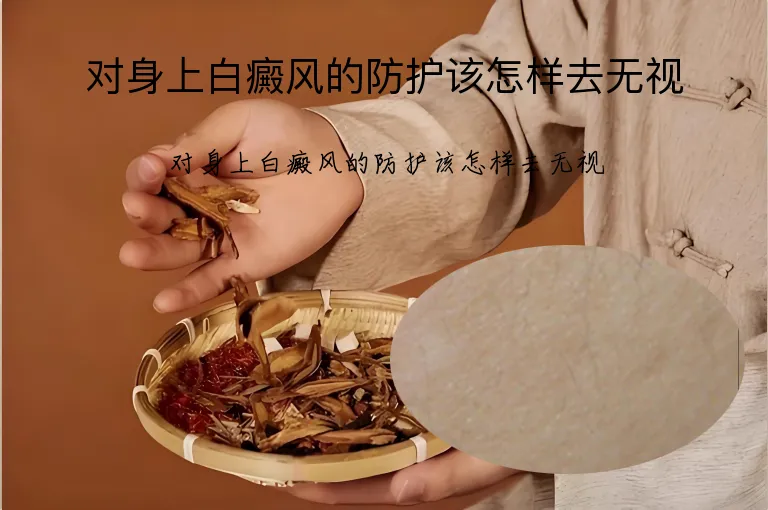 对身上白癜风的防护该怎样去无视