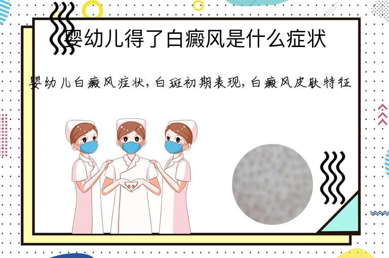 婴幼儿得了白癜风是什么症状