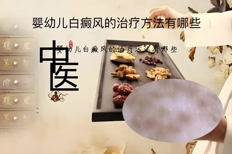 婴幼儿白癜风的治疗方法有哪些