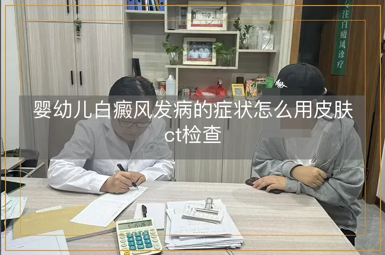 婴幼儿白癜风发病的症状怎么用皮肤ct检查