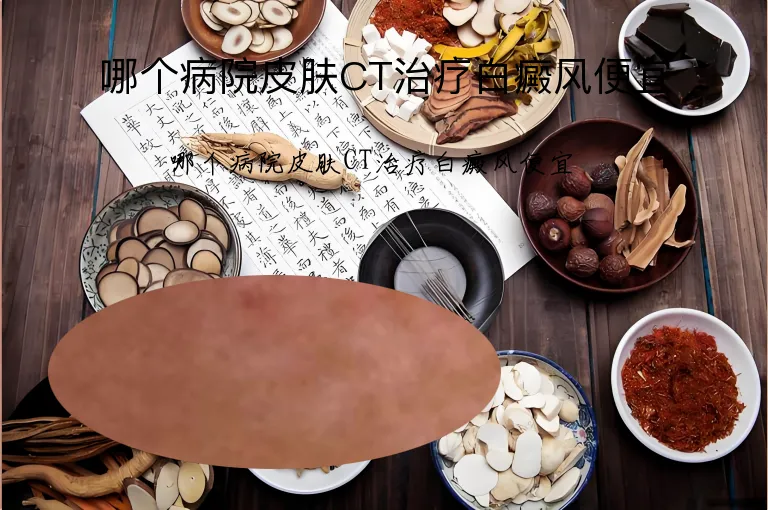 哪个病院皮肤CT治疗白癜风便宜