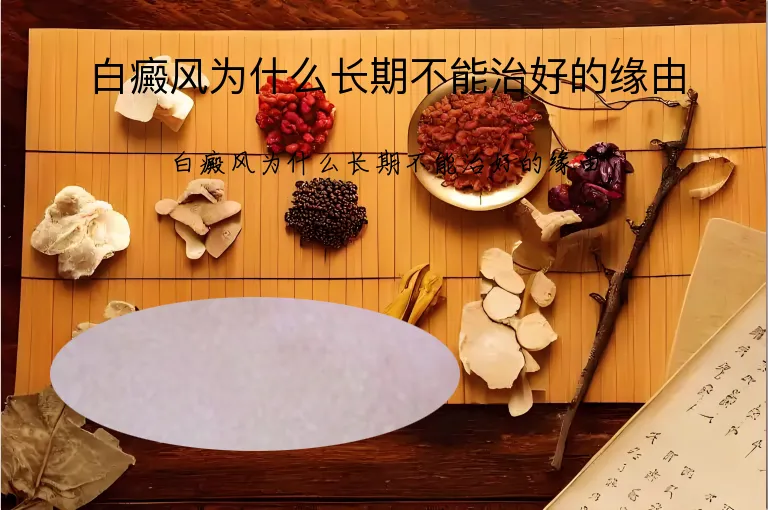 白癜风为什么长期不能治好的缘由