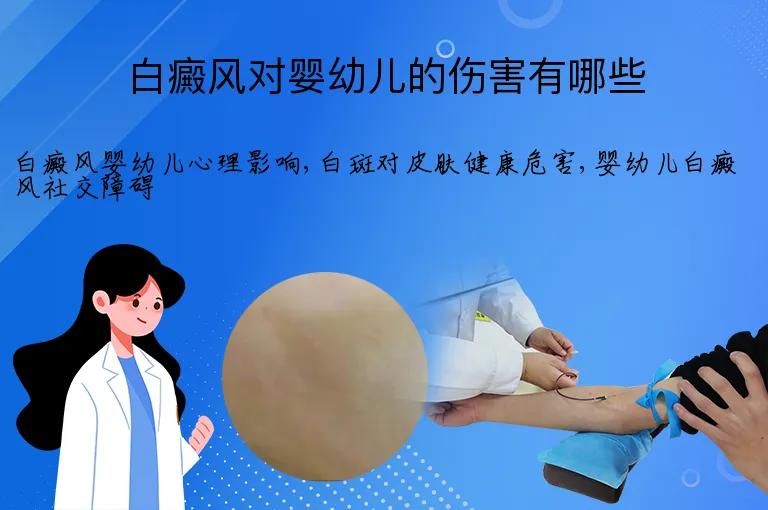 白癜风对婴幼儿的伤害有哪些