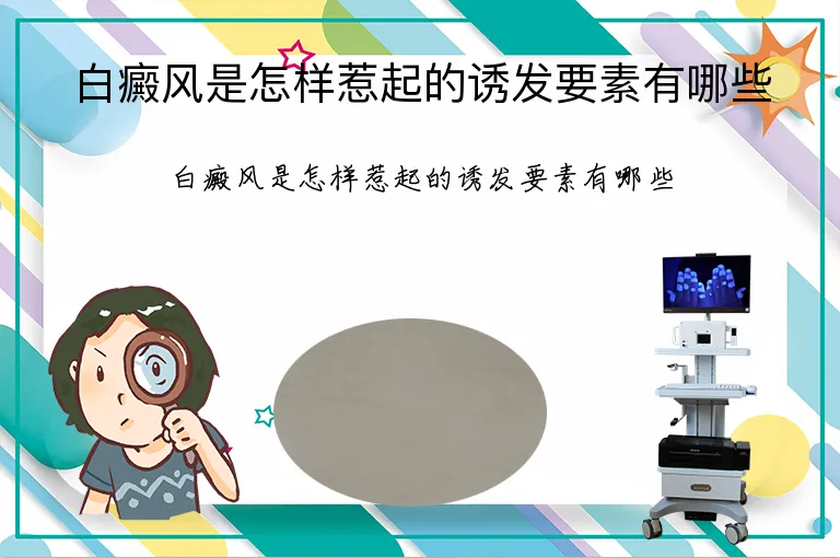 白癜风是怎样惹起的诱发要素有哪些