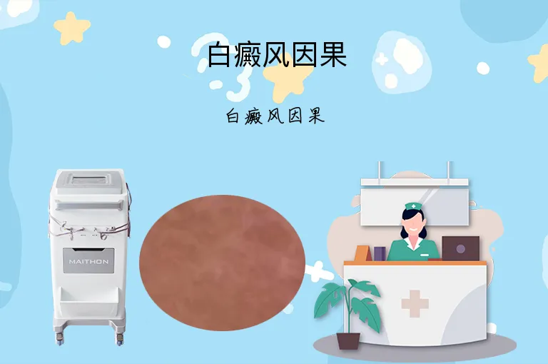 白癜风因果