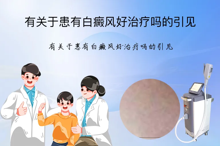 有关于患有白癜风好治疗吗的引见
